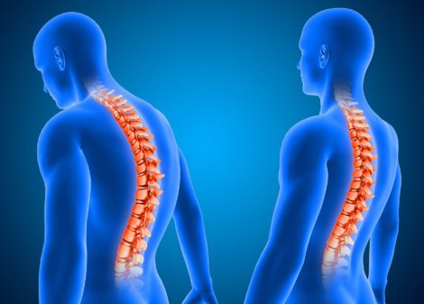 Gerinc helyes terhelése