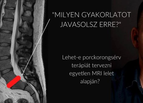 MRI lelet alapján gerinctorna gyakorlatok?